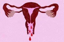 Uterus Illustration